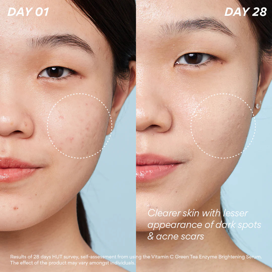 Innisfree Vitamin C Green Tea Enzyme Brightening Serum