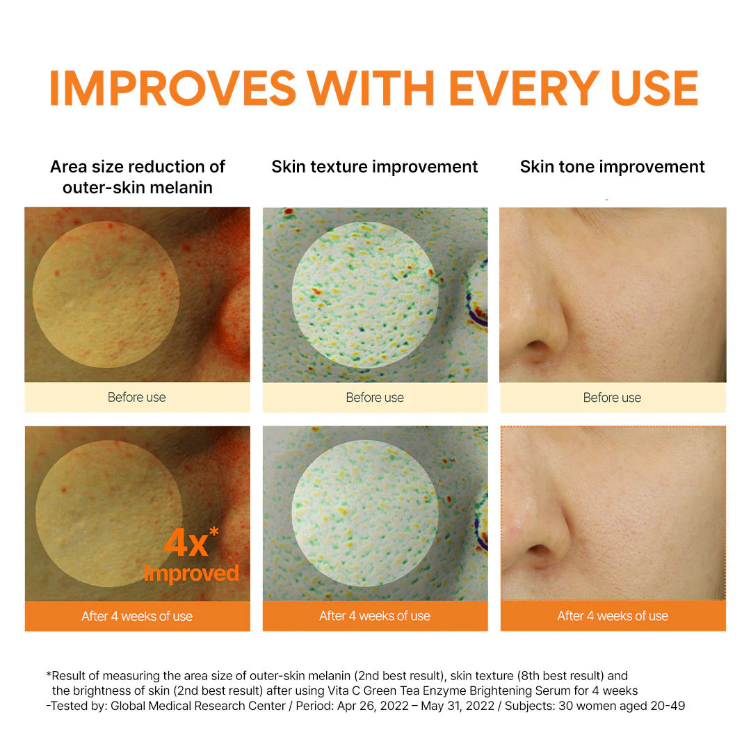 Innisfree Vitamin C Green Tea Enzyme Brightening Serum