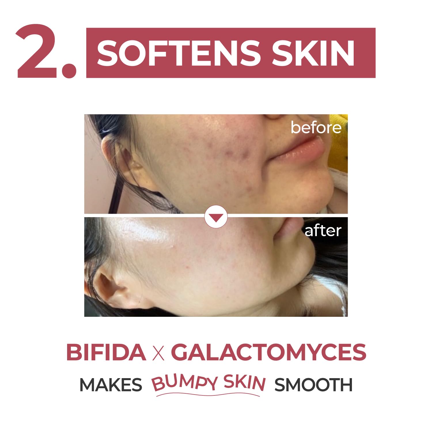Numbuzin - No.3 Skin Softening Serum (50ml)