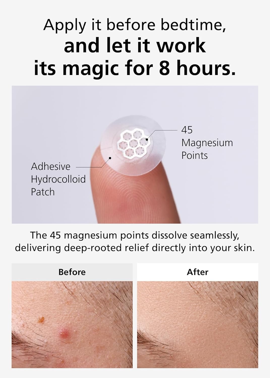 EasyDerm - Quick Calming magnesium patches
