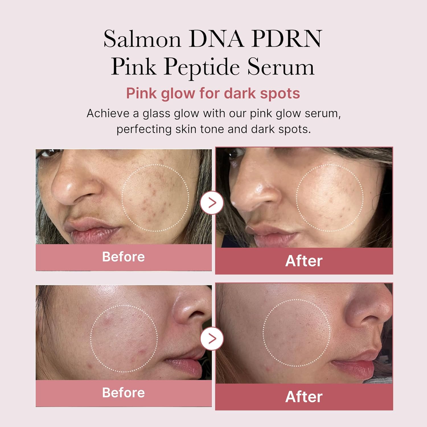 Medicube - Salmon DNA PDRN Pink Peptide Serum