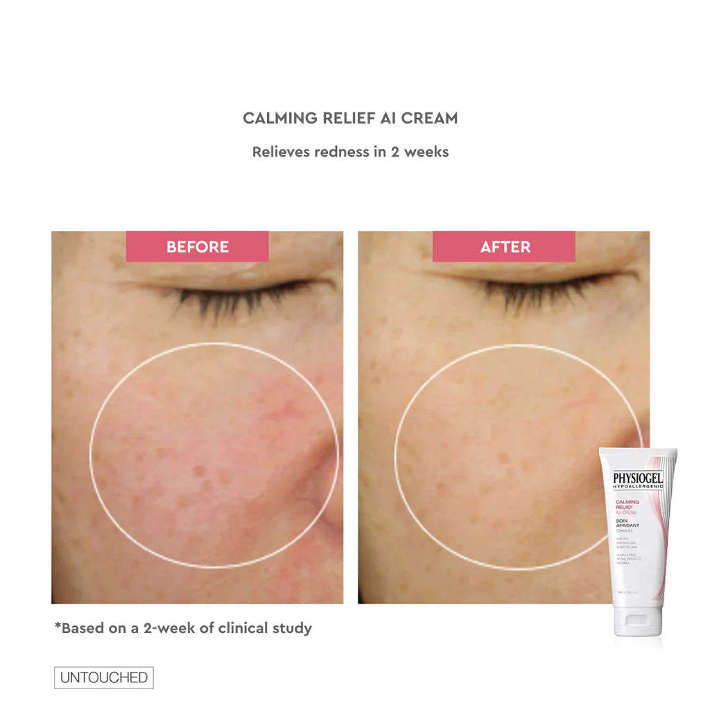 Physiogel calming relief facial cream